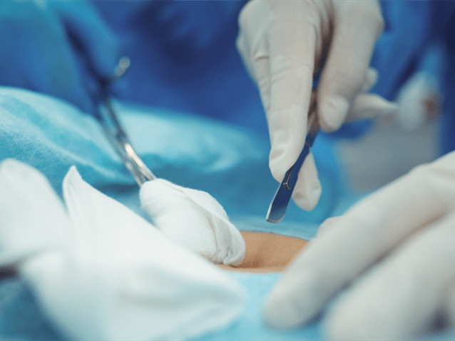 Família será indenizada após morte por compressa esquecida em cirurgia