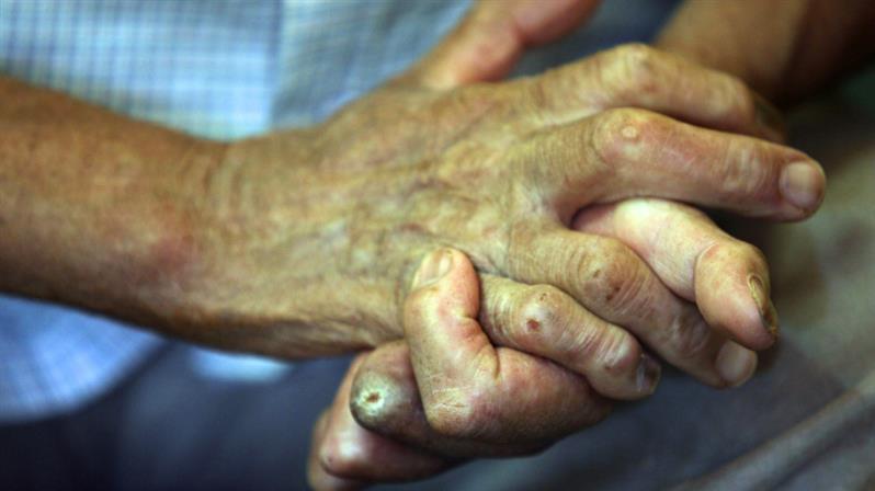  (Imagem: Alan Marques/Folhapress)