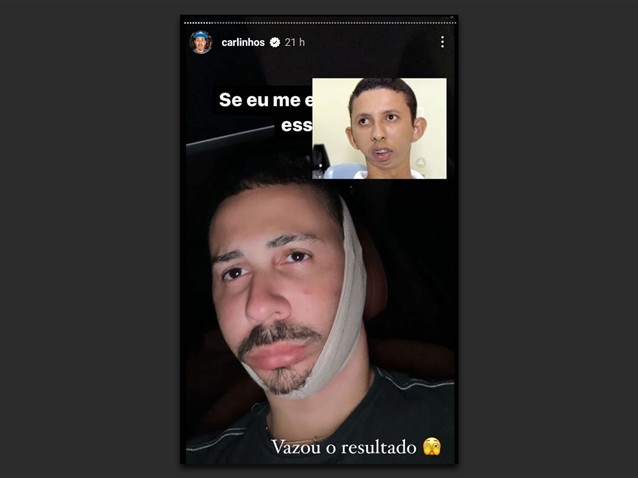 (img)